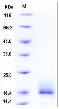 SDS-PAGE analysis of human ALK4 His tag protein