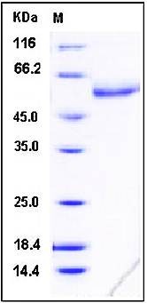 Western blot analysis of SDS-PAGE using H1N1 NA His tag protein