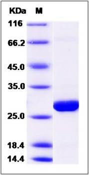 SDS-PAGE analysis of Human GSTZ1 protein (His Tag)