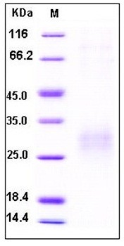 SDS-PAGE analysis of human SOST His tag protein