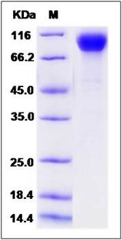 SDS-PAGE analysis of Rat PDGFRB protein (His Tag)