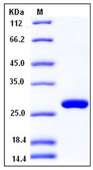 SDS-PAGE analysis of Human RPE His tag protein