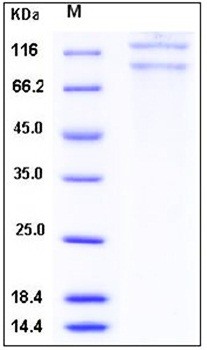 SDS-PAGE analysis of Human ITGAX flag His tag protein