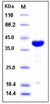SDS-PAGE analysis of human ACP1 GST tag protein