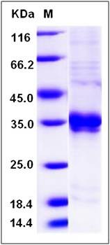 SDS-PAGE analysis of rat ASAM protein (His Tag)