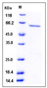 SDS-PAGE analysis of human CSNK1A1 GST tag protein