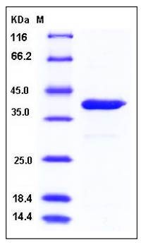 SDS-PAGE analysis of human ARG1 His tag protein
