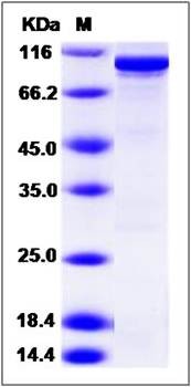 SDS-PAGE analysis of Human RIOK1 protein (GST Tag)