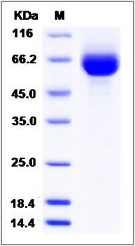 SDS-PAGE analysis of Human LILRA3 protein (His Tag)