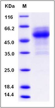 SDS-PAGE analysis of human C12ORF53 protein