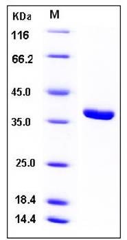 SDS-PAGE analysis of human ACYP1 GST tag protein