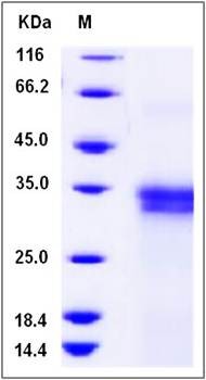 SDS-PAGE analysis of Human IFI30 protein (His Tag)