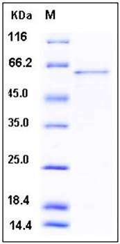 SDS-PAGE analysis of human GOLM1 His tag protein