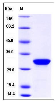 SDS-PAGE analysis of Human PTH protein (GST Tag)