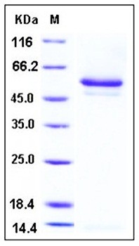 SDS-PAGE analysis of human SerpinI1 His tag protein