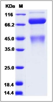 SDS-PAGE analysis of cynomolgus c-MET protein (His Tag)