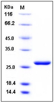 SDS-PAGE analysis of Human LYPLA2 His tag protein