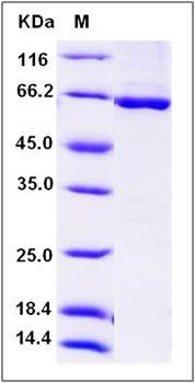 SDS-PAGE analysis of human Tie2 protein (GST Tag)