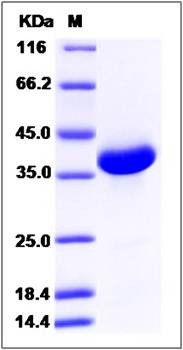 SDS-PAGE analysis of Human NRN1L protein