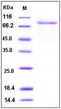 SDS-PAGE analysis of human GMCSFR Fc tag protein