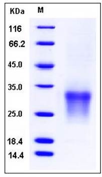 SDS-PAGE analysis of human CD82 His tag protein