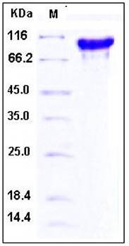 SDS-PAGE analysis of human FGFR4 Fc His tag protein