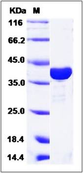 SDS-PAGE analysis of ADPRH (His Tag) protein