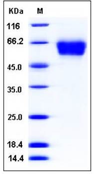 SDS-PAGE analysis of human CD62L His tag protein