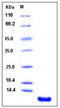 SDS-PAGE analysis of Human S100P protein
