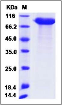 SDS-PAGE analysis of cynomolgus AMY2A protein
