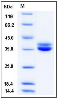 SDS-PAGE analysis of human GPA33 His tag protein