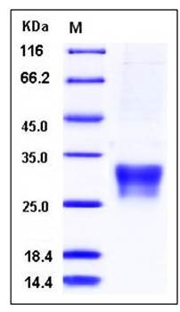 SDS-PAGE analysis of Ferret CD8A His tag protein
