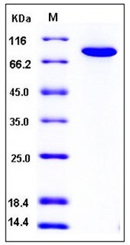SDS-PAGE analysis of human TGM2 His tag protein