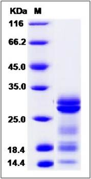 SDS-PAGE analysis of Human VTI1A protein (His Tag)
