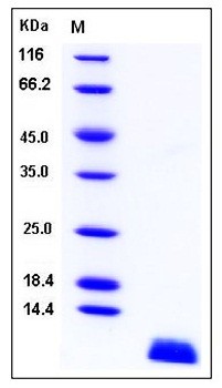 SDS-PAGE analysis of Human SCGB1A1 His tag protein