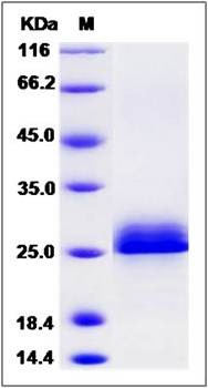 SDS-PAGE analysis of human SRGN protein (His & MYC Tag)