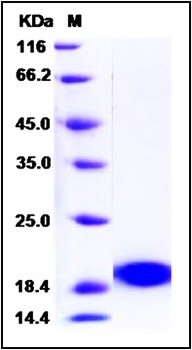 SDS-PAGE analysis of Human PLA2G1B His tag protein