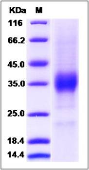 SDS-PAGE analysis of Human KIR2DL4 protein