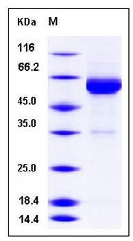 SDS-PAGE analysis of Human IL17RC protein (His Tag)