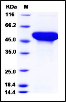 SDS-PAGE analysis of human ADSL protein (His Tag)