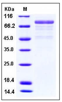 SDS-PAGE analysis of human CDH12 His tag protein