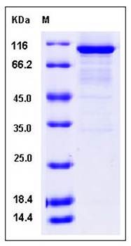 SDS-PAGE analysis of human DCLK1 protein (GST Tag)