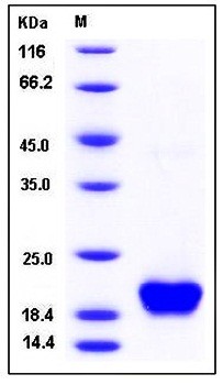 SDS-PAGE analysis of Human NUDT2 His tag protein