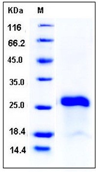 SDS-PAGE analysis of Human IGJ His tag protein