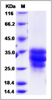 SDS-PAGE analysis of Cynomolgus FAS protein