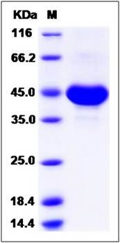 SDS-PAGE analysis of Human TSPAN8 protein