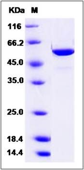 SDS-PAGE analysis of Hamster FUT8 protein (His Tag)