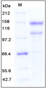SDS-PAGE analysis of Human LDLR His tag protein