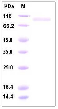 SDS-PAGE analysis of human CD10 protein