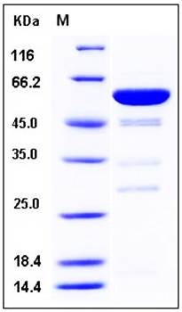 SDS-PAGE analysis of human Galectin 8 GST tag protein